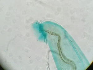 Rat lungworm parasite 